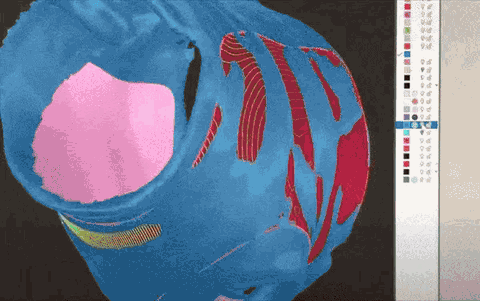 A 3D scan of a limb being edited on screen, with colored regions marking pressure and relief zones.